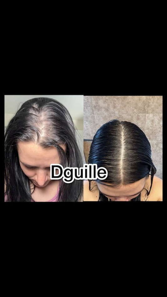 H. Kit receta Dguille