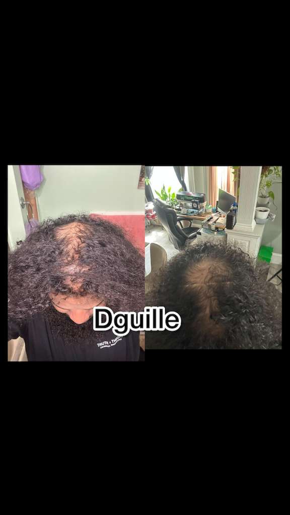 D. Extra Concentrated Shampoo