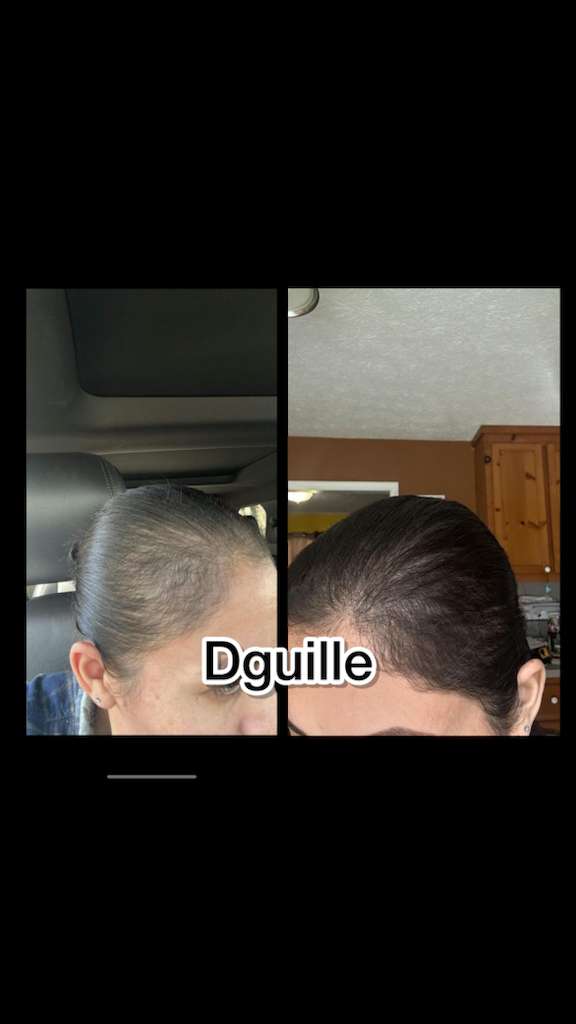 A. Biotin and Collagen Concentrate