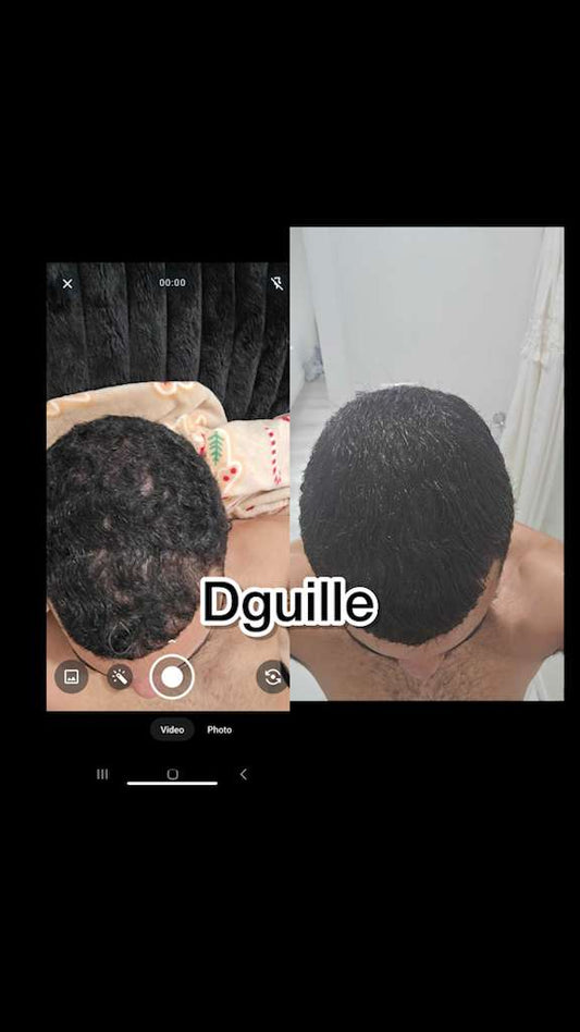 5X Hair Growth Kit. FREE SHIPPING