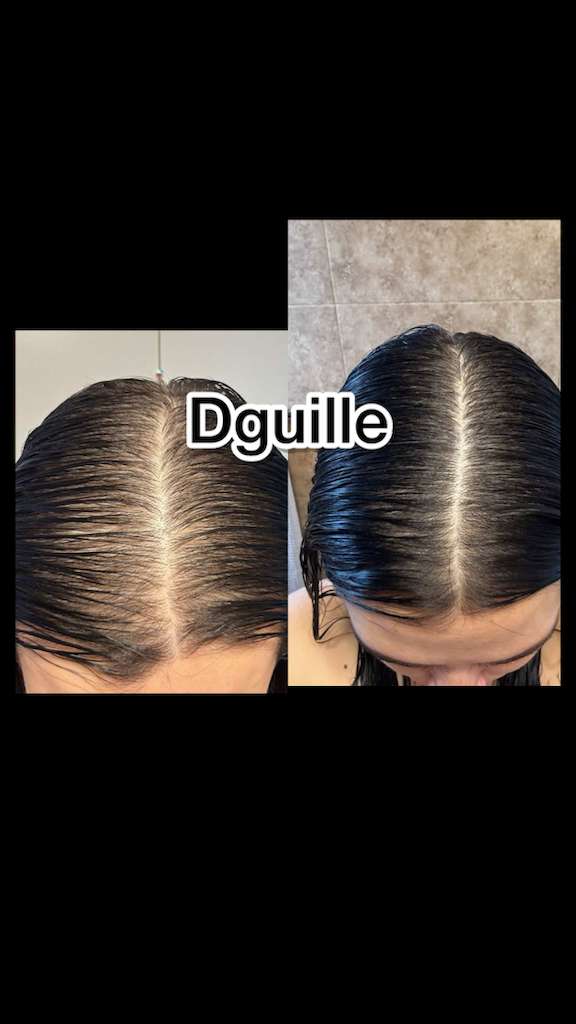 H. Kit receta Dguille