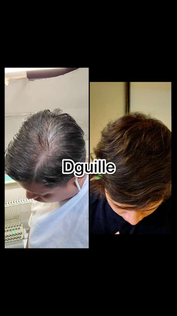 C. Hair Growth Herbal Booster – Doña Guille’s Formula