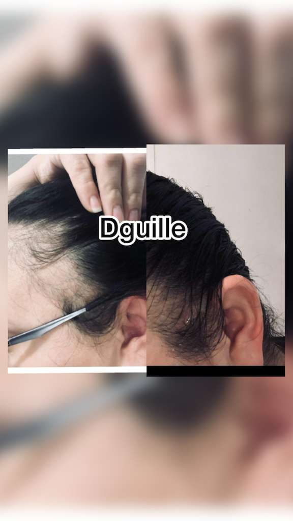 5X Hair Growth Kit. FREE SHIPPING